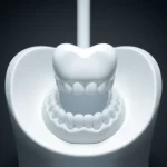 Clínica de Ortodoncia invisible en pozuelo de alarcon